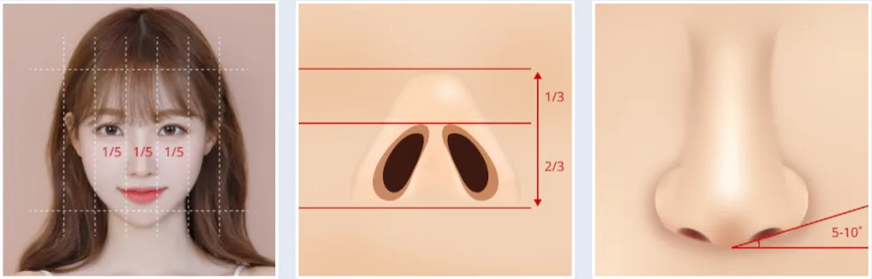 Illustrative diagrams explaining ideal nasal proportions and nostril angles, highlighting facial balance guidelines used in alarplasty rhinoplasty  and alar reduction for refined nasal width and symmetry.