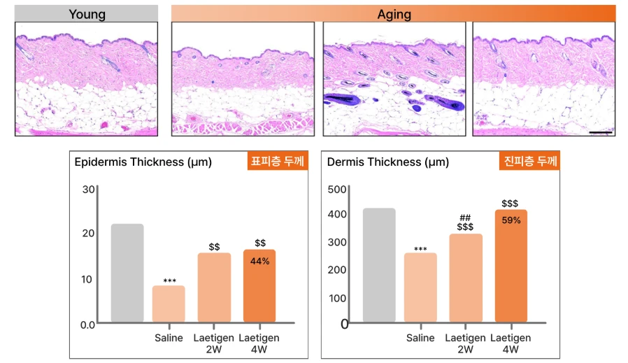 Laetigen skin booster and collagen clinical comparison showing young vs aging skin tissue images and graphs of increased epidermis and dermis thickness after Laetigen treatment.