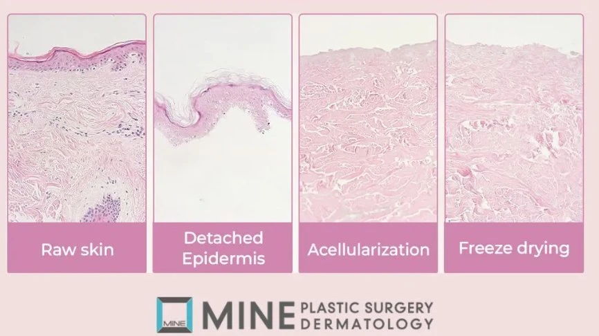 Microscopic histology images showing Laetigen collagen skin booster dermal regeneration process — raw skin, detached epidermis, acellularization, and freeze drying stages at Mine Clinic Seoul Korea.
