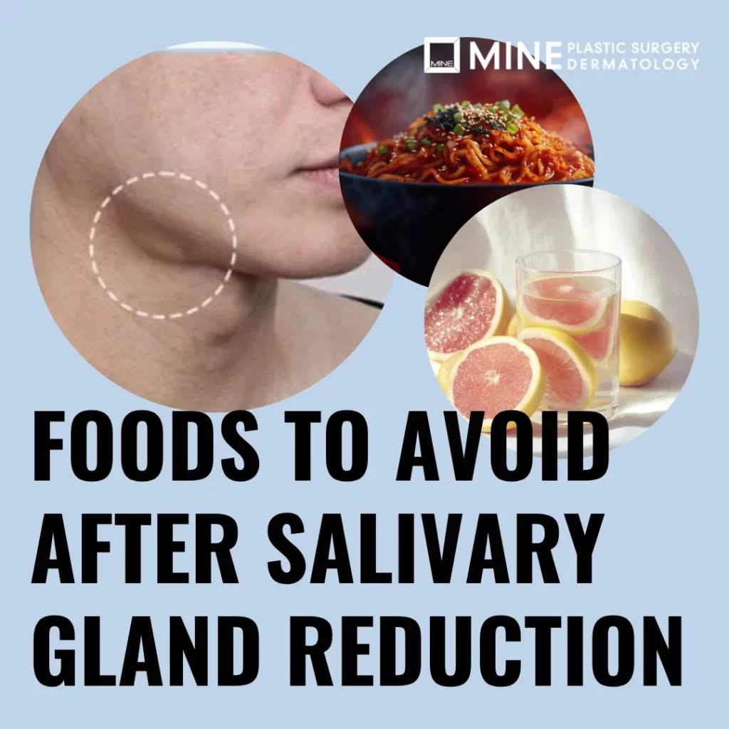 Mine Clinic featured graphic titled "Foods to Avoid After Salivary Gland Reduction," showing the jawline gland area, spicy noodles, and sour citrus.