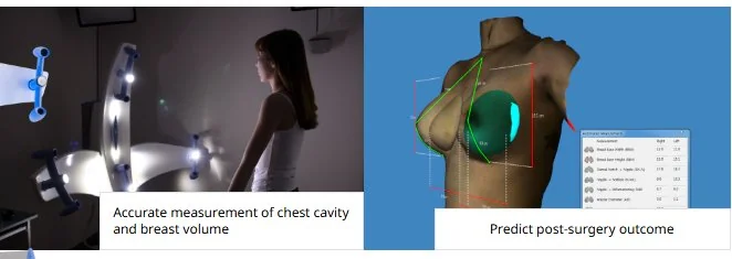 3D imaging for breast augmentation drop and fluff planning at Mine Clinic Seoul, measuring chest cavity and breast volume to predict the post-surgery settled outcome.