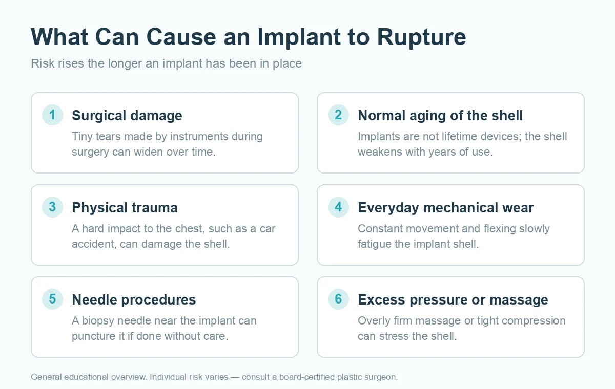 Infographic summarizing the common causes of breast augmentation implant rupture, including shell aging, physical trauma, surgical handling and capsular contracture.