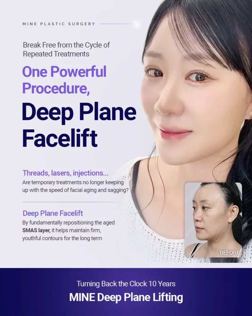 Deep plane facelift SMAS layer repositioning at Mine Clinic in Korea.