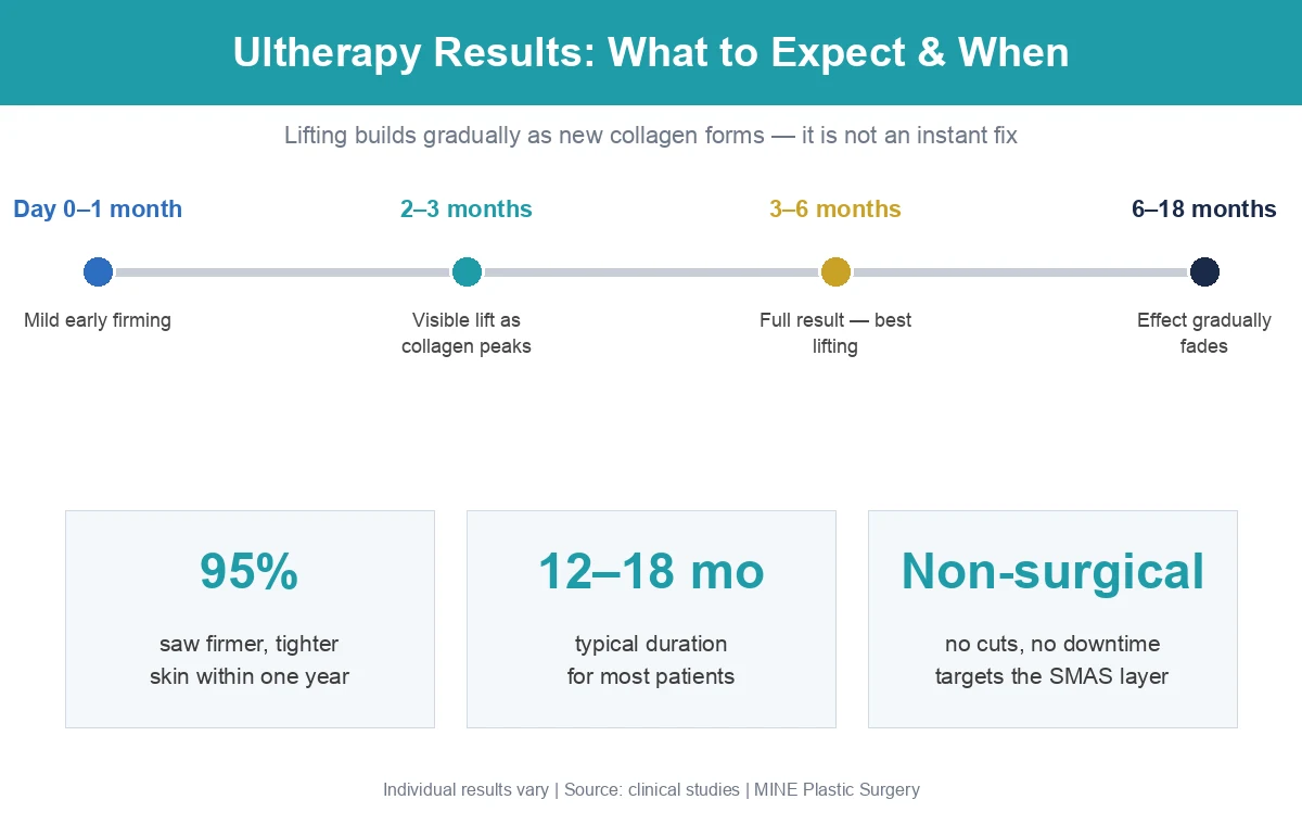 Ultherapy results timeline infographic showing skin lifting builds over 3 to 6 months and lasts 12 to 18 months