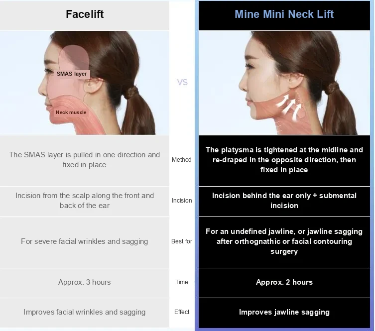 Comparison chart of a full facelift versus the MINE mini neck lift for a sagging jawline, covering method, incision, best candidates, operating time and effect.