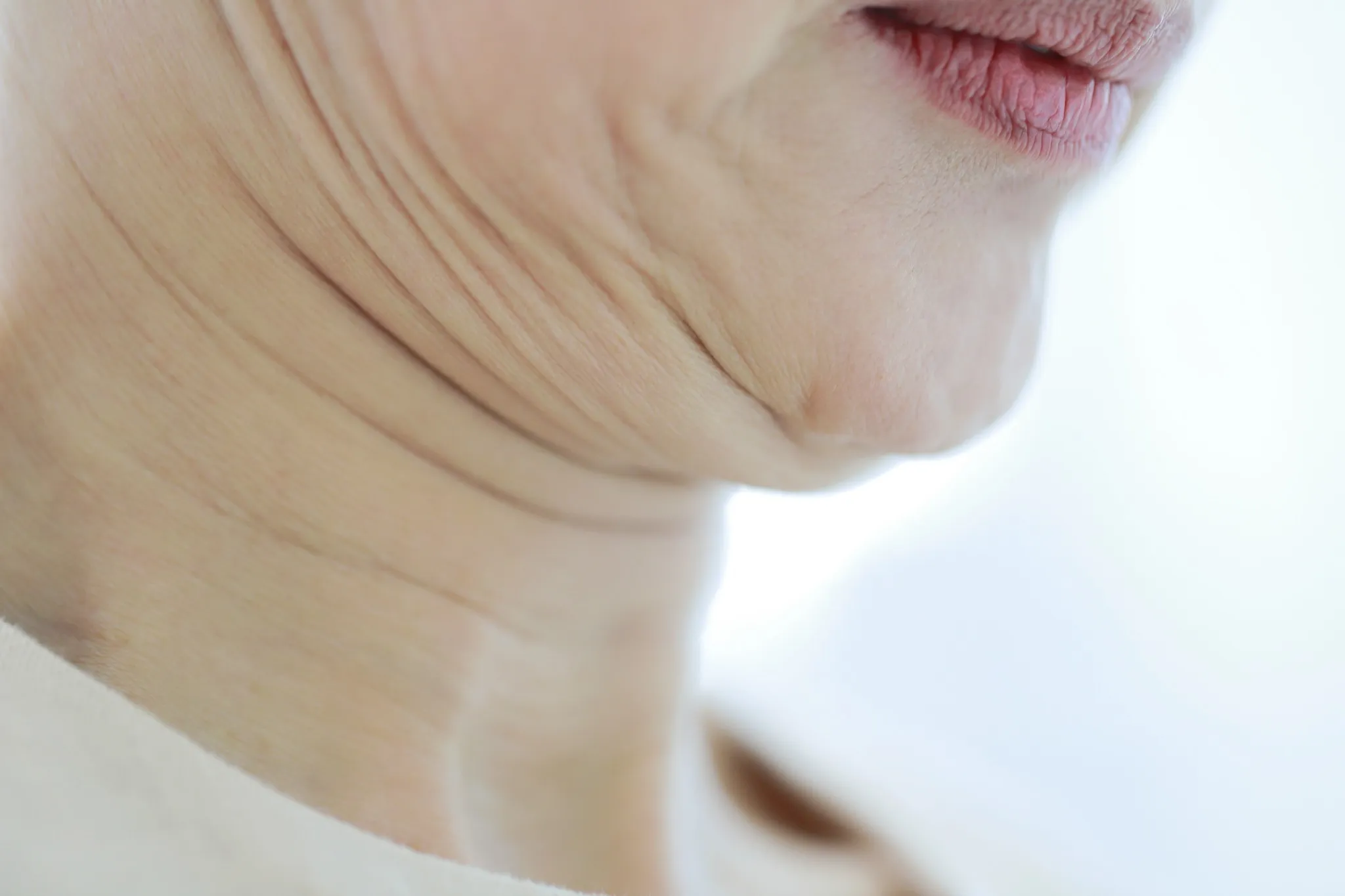 Close-up side view of horizontal neck wrinkles and lax skin under the jaw, the aging changes a neck lifting procedure is designed to address