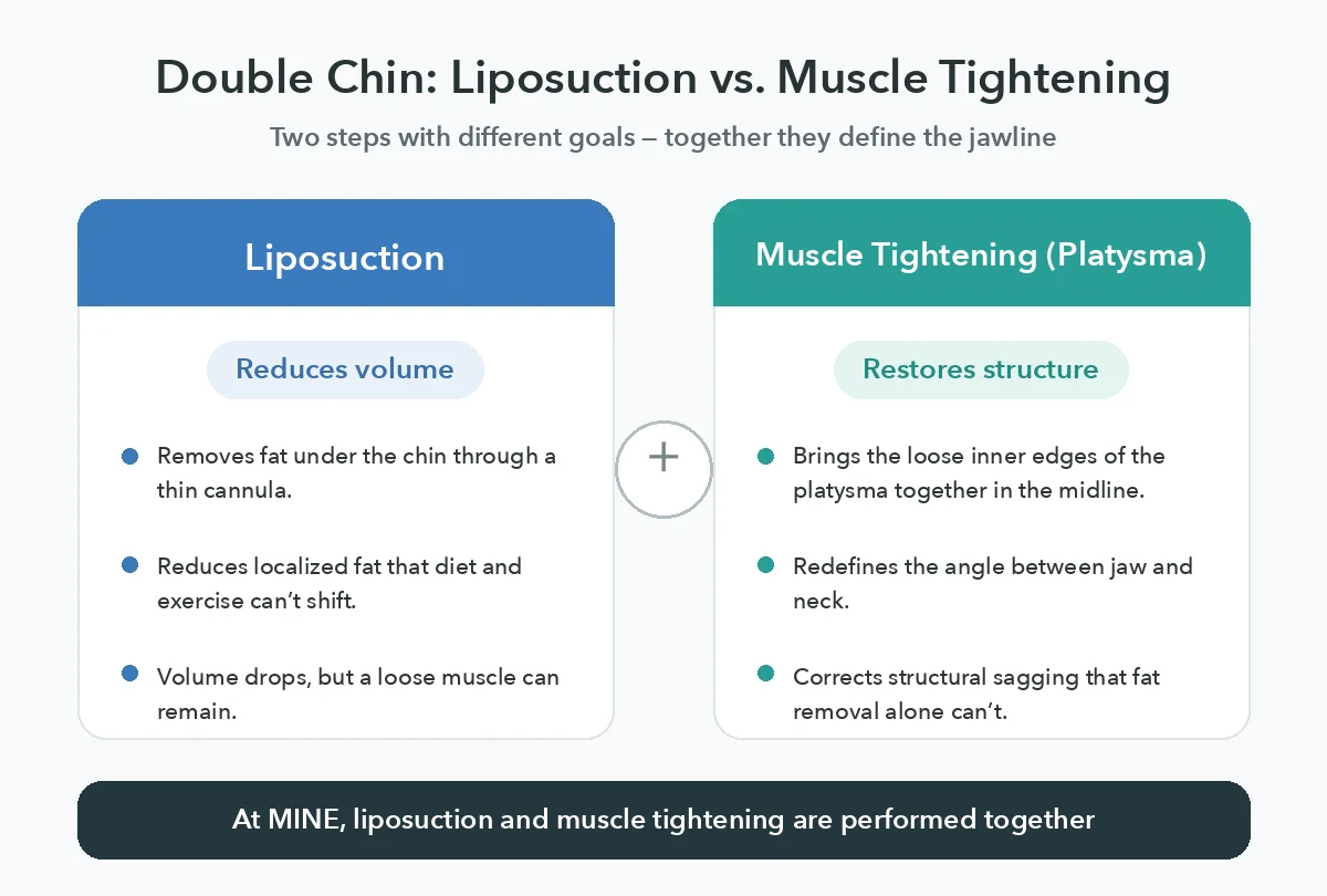 Infographic for a double chin when skinny: liposuction reduces volume while platysma muscle tightening restores structure