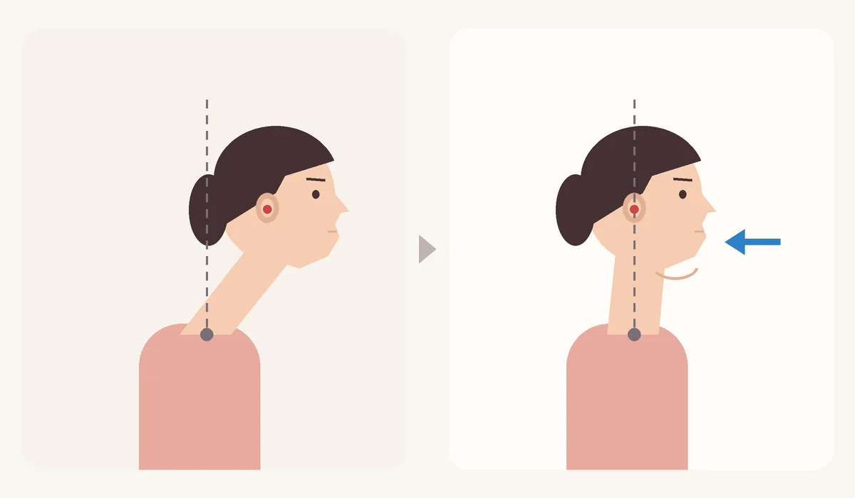 Chin tuck diagram for double chin exercises: from a forward-head posture, the chin glides straight back until the ear lines up over the shoulder