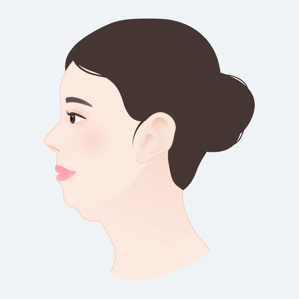 Illustrated side profile of a slim woman with a soft double chin when skinny, showing fullness under the jaw