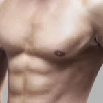 Gynecomastia surgery scars guide — front view of a lean male chest