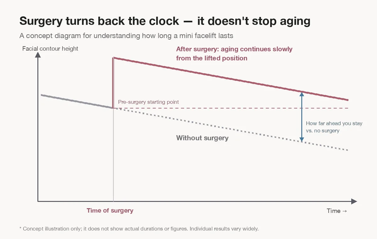 How long does a mini facelift last? Concept graph showing facial contour lifted at the time of surgery, then aging slowly while staying ahead of no surgery