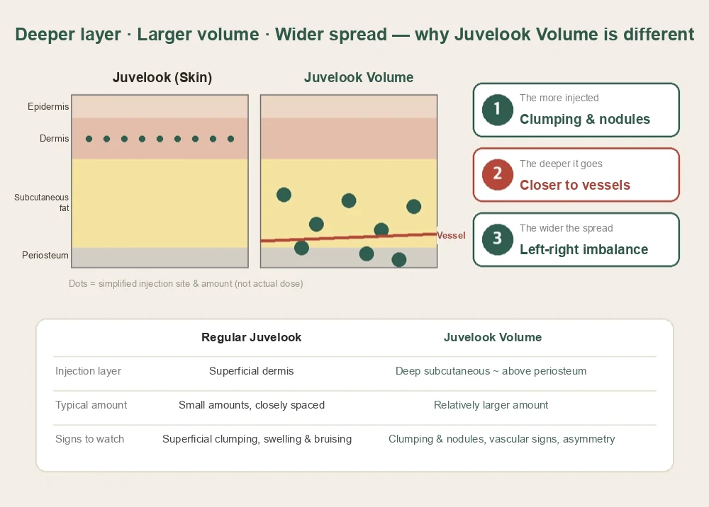 Diagram of why juvelook volume side effects differ: deeper layer, larger dose and wider spread than regular Juvelook