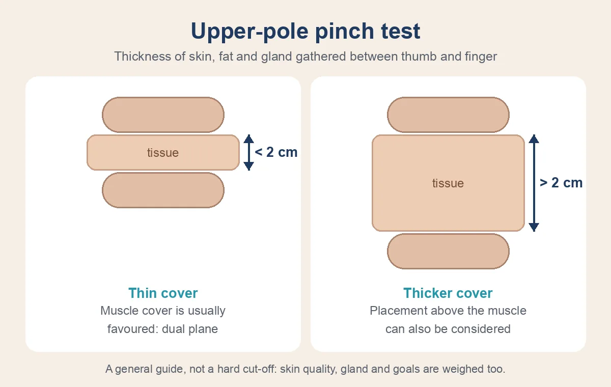 Upper-pole pinch test diagram: under about 2 cm of tissue usually favors a dual plane pocket