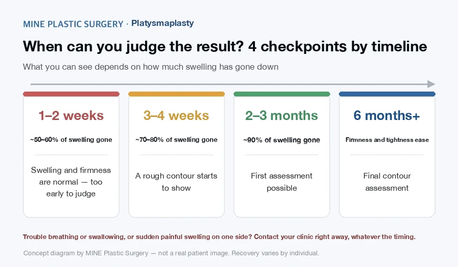 Recovery timeline for patients worried about platysmaplasty not working: 4 checkpoints at 1–2 weeks, 3–4 weeks, 2–3 months and 6 months+ with typical swelling reduction