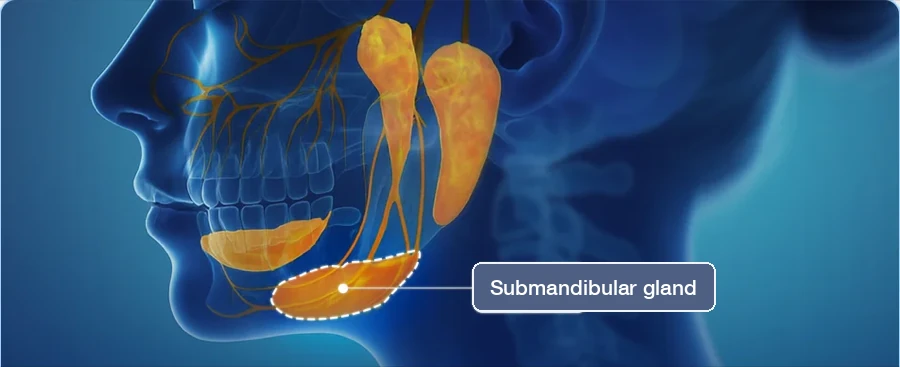 3D anatomy showing the submandibular gland below the jawline, a common reason for platysmaplasty not working as expected