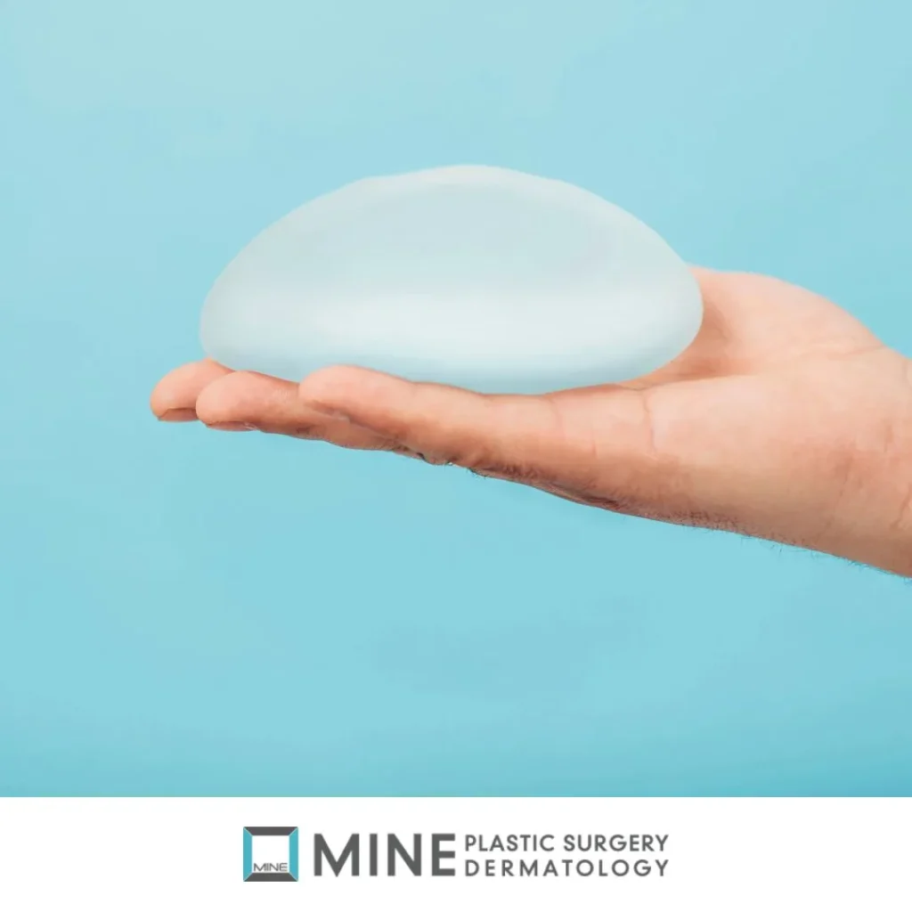 Silicone breast implant resting on an open hand, one of the options covered in this guide to types of breast surgery