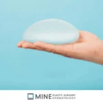 Silicone breast implant resting on an open hand, one of the options covered in this guide to types of breast surgery
