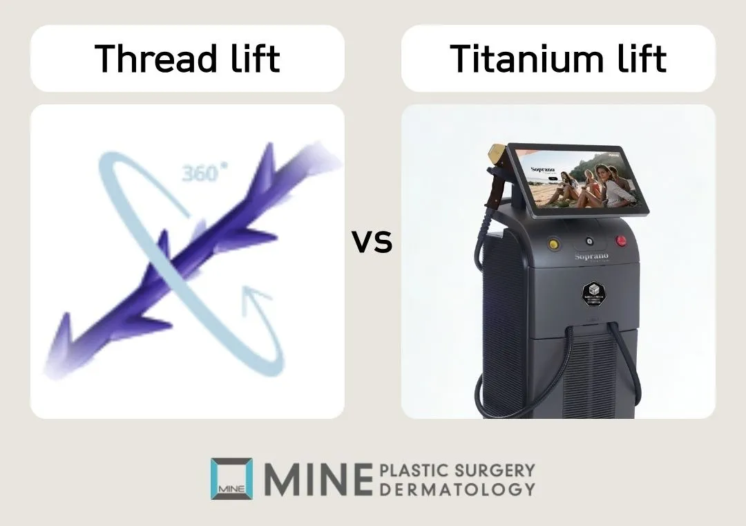 Thread lift vs Titanium Lifting graphic comparing a barbed lifting thread with the Soprano laser device