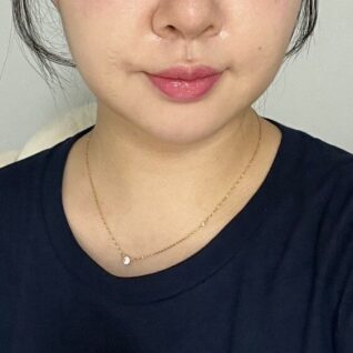 이중턱 근육묶기