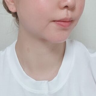 이중턱 근육묶기