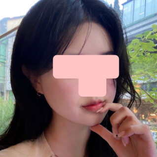 이중턱 근육묶기