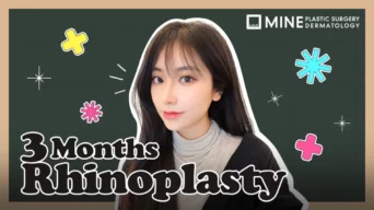 [Nose tip + Alar reduction ] Rhinoplasty 3 Months